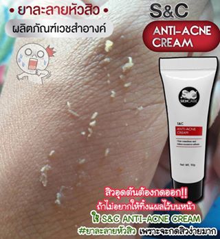 .❌✰เราเข้าใจดีคะว่ากดสิวไม่ออกเป็นไง? -รำคาน และไม่ชอบใช่ไหมที่มีสิวอุดตัน ❗️ ?ต้องใช้นะคะ ถึงจะกดง่าย สิวจะหลุดออก !?" S&C ANTI-ACNE CREAM #ยาละลายหัวสิว " ?#scskincare #skincare #sc #soap #serum #plankton #whiteskin #vitc #lemon #mangosteen #sunscreen #cream #quality #scskincare_thailand  #เซรั่มน้ำแร่แพลงก์ตอน  #กันแดดแพลงก์ตอน #ครีมแพลงก์ตอน  #สบู่เอสซี #สบู่3ลอก #สบู่ลอกคราบ #สบู่ลอกผิว #สบู่ลอกหน้า #สบู่ผิวขาว #ครีมผิวขาว #กันแดดผิว #เซรั่มหน้าใส #สกินแคร์ #รับสมัครตัวแทนจำหน่าย  #ยาละลายหัวสิว
